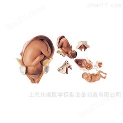 足月胎儿分娩过程演示训练模型-足月胎儿模型-胎儿分娩模型