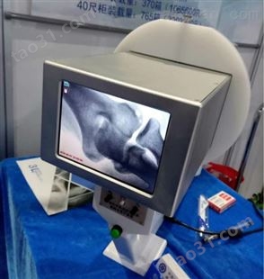 手提式X光机/骨伤手法复位检视仪